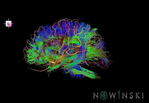 G2.T14.1-15.2.V2.C5-2.L0.White matter tracts all–Intracranial arteries all
