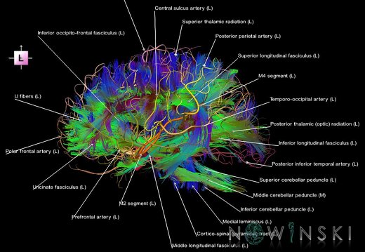 G2.T14.1-15.2.V2.C5-2.L1.White matter tracts all–Intracranial arteries all