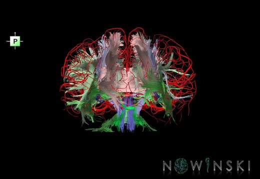 G2.T14.1-15.2.V3.C2-1.L0.White matter tracts all–Intracranial arteries all