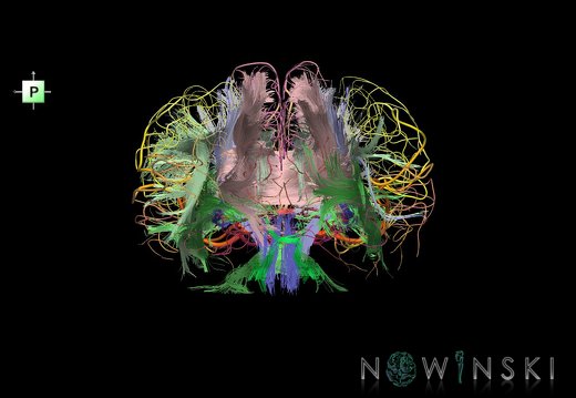 G2.T14.1-15.2.V3.C2-2.L0.White matter tracts all–Intracranial arteries all