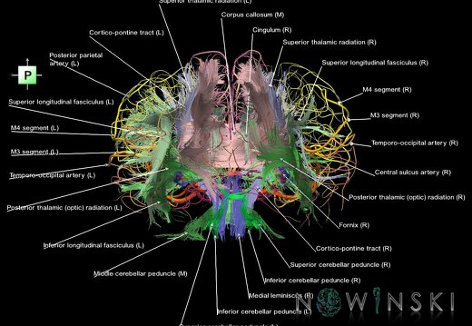 G2.T14.1-15.2.V3.C2-2.L1.White matter tracts all–Intracranial arteries all