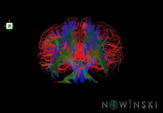 G2.T14.1-15.2.V3.C5-1.L0.White matter tracts all–Intracranial arteries all