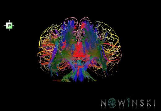 G2.T14.1-15.2.V3.C5-2.L0.White matter tracts all–Intracranial arteries all