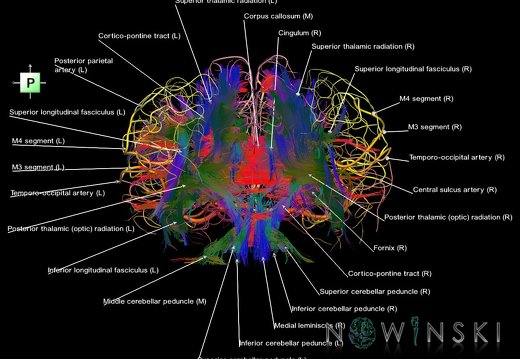 G2.T14.1-15.2.V3.C5-2.L1.White matter tracts all–Intracranial arteries all