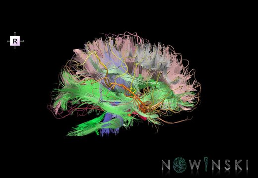 G2.T14.1-15.2.V4.C2-2.L0.White matter tracts all–Intracranial arteries all