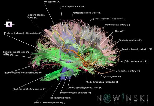 G2.T14.1-15.2.V4.C2-2.L1.White matter tracts all–Intracranial arteries all