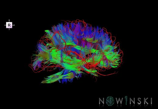 G2.T14.1-15.2.V4.C5-1.L0.White matter tracts all–Intracranial arteries all