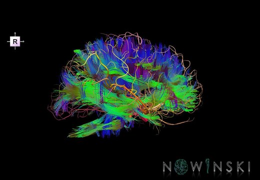 G2.T14.1-15.2.V4.C5-2.L0.White matter tracts all–Intracranial arteries all