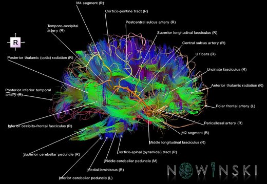 G2.T14.1-15.2.V4.C5-2.L1.White matter tracts all–Intracranial arteries all