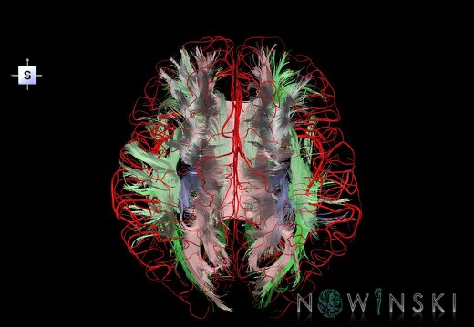 G2.T14.1-15.2.V5.C2-1.L0.White matter tracts all–Intracranial arteries all