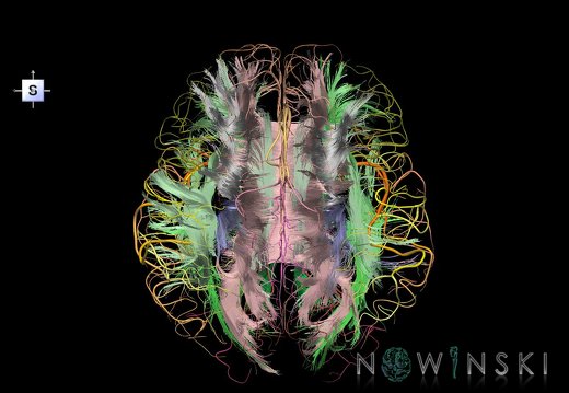 G2.T14.1-15.2.V5.C2-2.L0.White matter tracts all–Intracranial arteries all