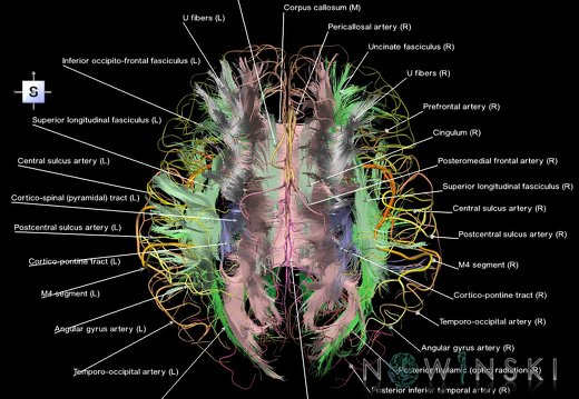 G2.T14.1-15.2.V5.C2-2.L1.White matter tracts all–Intracranial arteries all