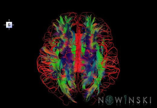 G2.T14.1-15.2.V5.C5-1.L0.White matter tracts all–Intracranial arteries all