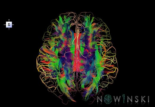 G2.T14.1-15.2.V5.C5-2.L0.White matter tracts all–Intracranial arteries all