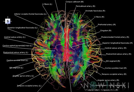 G2.T14.1-15.2.V5.C5-2.L1.White matter tracts all–Intracranial arteries all