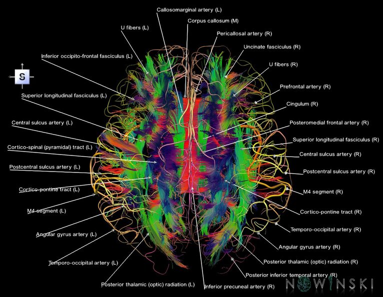 G2.T14.1-15.2.V5.C5-2.L1.White_matter_tracts_all–Intracranial_arteries_all.tiff