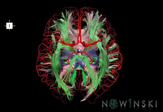 G2.T14.1-15.2.V6.C2-1.L0.White matter tracts all–Intracranial arteries all