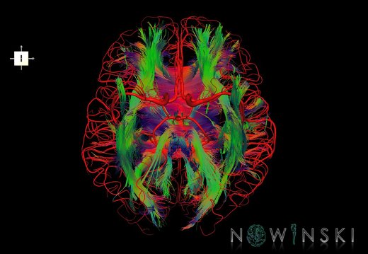 G2.T14.1-15.2.V6.C5-1.L0.White matter tracts all–Intracranial arteries all