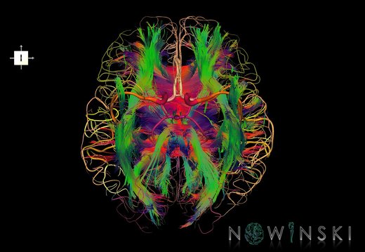 G2T14.1-15.2.WhiteMatterTractsAll-IntracranialArteriesAll