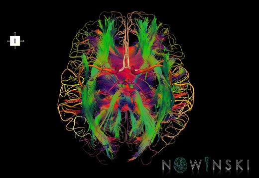 G2.T14.1-15.2.V6.C5-2.L0.White matter tracts all–Intracranial arteries all