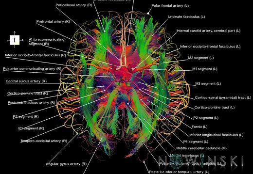 G2.T14.1-15.2.V6.C5-2.L1.White matter tracts all–Intracranial arteries all