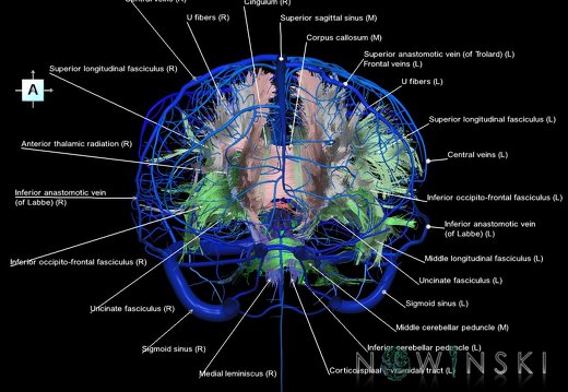 G2.T14.1-16.1.V1.C2-2.L1.White matter tracts all–Intracranial venous system whole
