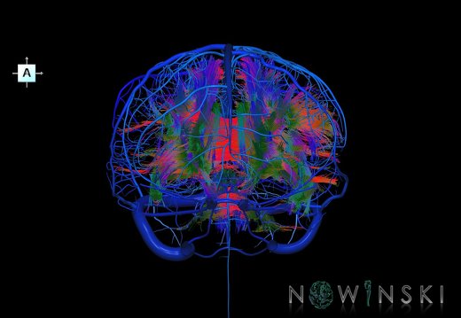 G2.T14.1-16.1.V1.C5-2.L0.White matter tracts all–Intracranial venous system whole
