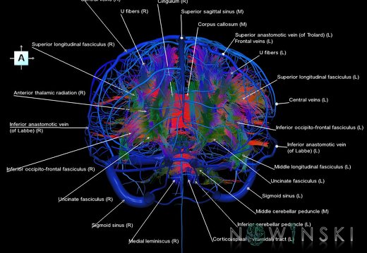 G2.T14.1-16.1.V1.C5-2.L1.White matter tracts all–Intracranial venous system whole