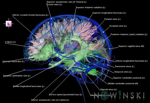 G2.T14.1-16.1.V2.C2-2.L1.White matter tracts all–Intracranial venous system whole
