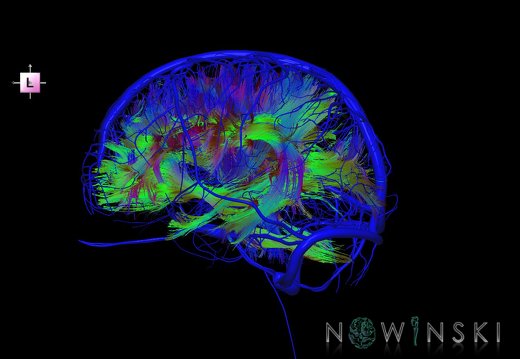 G2.T14.1-16.1.V2.C5-1.L0.White matter tracts all–Intracranial venous system whole
