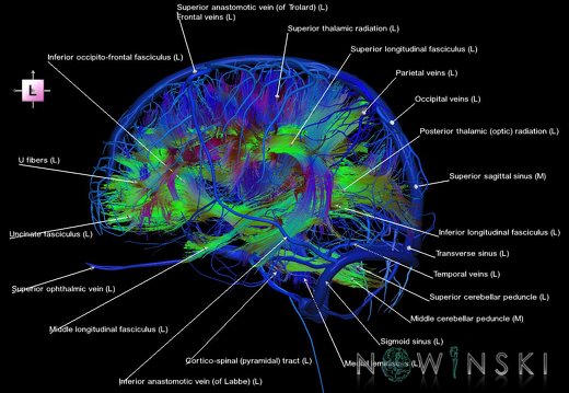 G2.T14.1-16.1.V2.C5-2.L1.White matter tracts all–Intracranial venous system whole