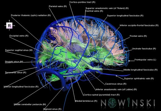 G2T14.1-16.1.WhiteMatterTractsAll-IntracranialVenousSystemWhole