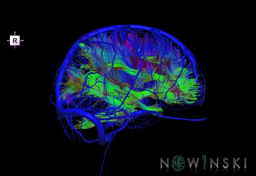 G2.T14.1-16.1.V4.C5-1.L0.White matter tracts all–Intracranial venous system whole