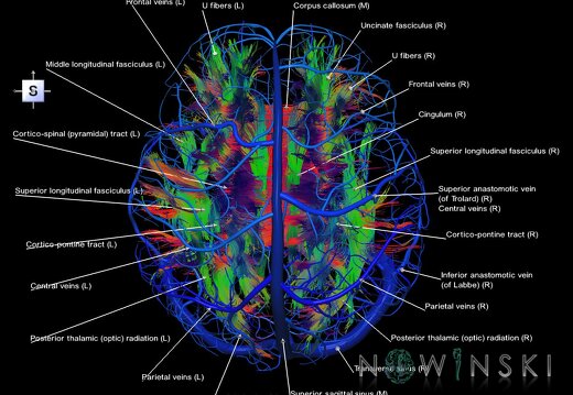 G2.T14.1-16.1.V5.C5-2.L1.White matter tracts all–Intracranial venous system whole