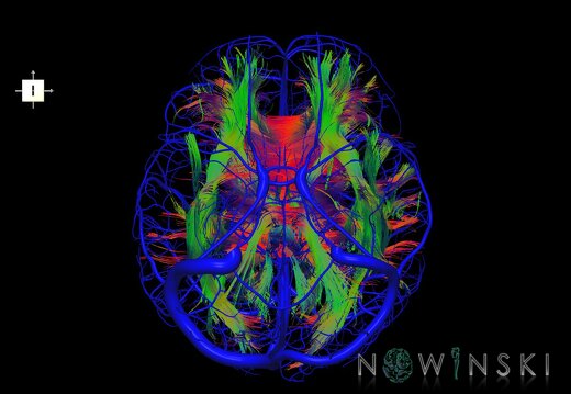 G2.T14.1-16.1.V6.C5-1.L0.White matter tracts all–Intracranial venous system whole