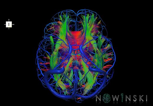 G2.T14.1-16.1.V6.C5-2.L0.White matter tracts all–Intracranial venous system whole