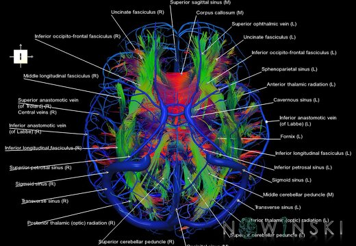 G2.T14.1-16.1.V6.C5-2.L1.White matter tracts all–Intracranial venous system whole