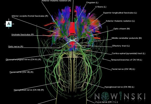G2.T14.1-19.1.V1.C5-2.L1.White matter tracts all–Cranial nerves all