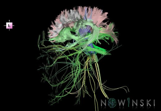 G2.T14.1-19.1.V2.C2.L0.White matter tracts all–Cranial nerves all