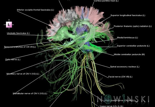 G2.T14.1-19.1.V2.C2.L1.White matter tracts all–Cranial nerves all
