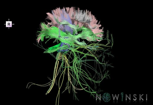G2.T14.1-19.1.V4.C2.L0.White matter tracts all–Cranial nerves all