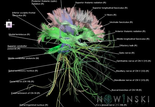 G2.T14.1-19.1.V4.C2.L1.White matter tracts all–Cranial nerves all