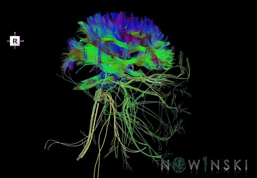 G2.T14.1-19.1.V4.C5-2.L0.White matter tracts all–Cranial nerves all