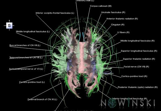 G2.T14.1-19.1.V5.C2.L1.White matter tracts all–Cranial nerves all
