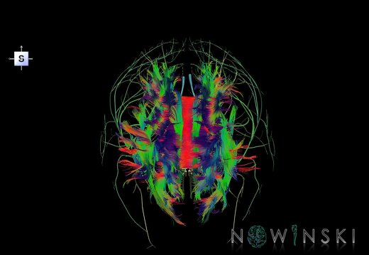 G2.T14.1-19.1.V5.C5-2.L0.White matter tracts all–Cranial nerves all