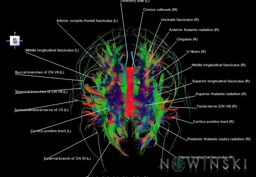 G2.T14.1-19.1.V5.C5-2.L1.White matter tracts all–Cranial nerves all