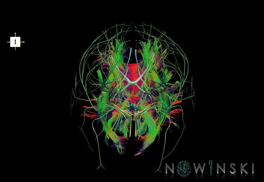 G2.T14.1-19.1.V6.C5-2.L0.White matter tracts all–Cranial nerves all