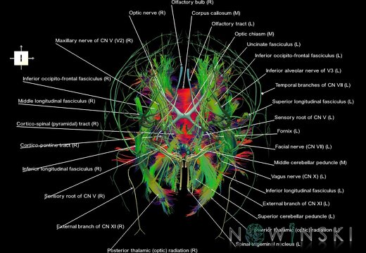 G2.T14.1-19.1.V6.C5-2.L1.White matter tracts all–Cranial nerves all