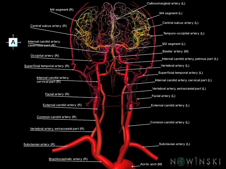 G2.T15.2-17.2.V1.C2.L1.Intracranial arterial system whole-Extracranial arteries all