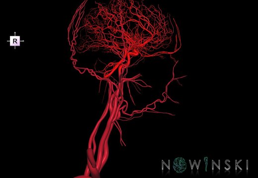 G2T15.2-17.2.Intracranial-ExtracranialArteriesAll